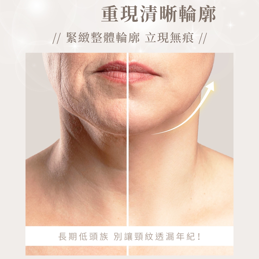 Beroso倍麗森 7D 光雕緊緻美容儀 - 詳情7