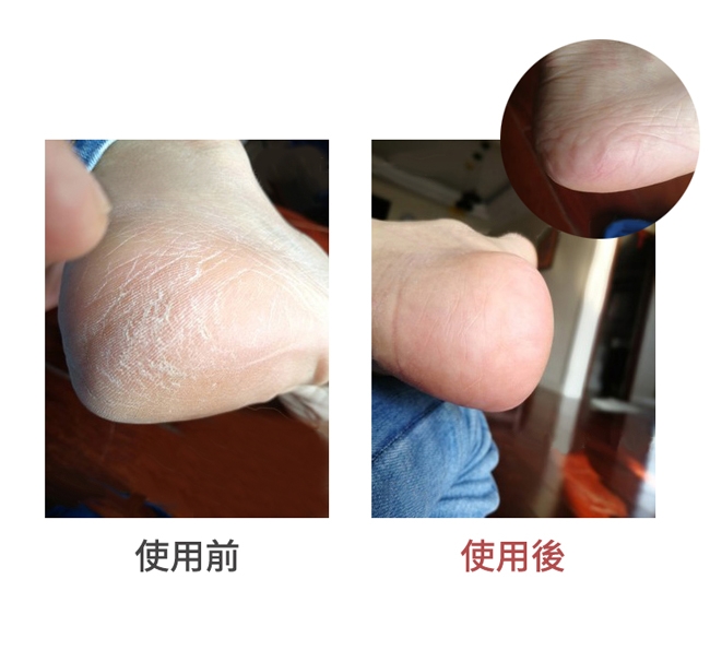 Concern康生 CON-FT204 - 詳情7