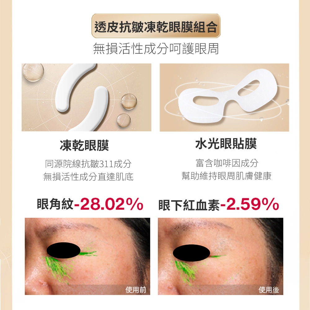 AMIRO R3 TURBO 美容儀 - 詳情14