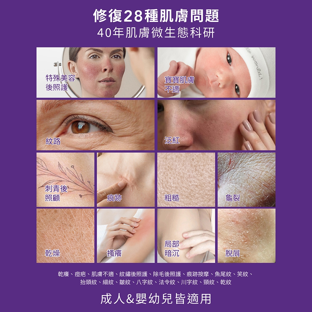 特殊美容後照護修復28種肌膚問題40年肌膚微生態科研寶寶肌膚不適紋路泛紅 刺青後照顧痕跡粗糙龜裂乾燥局部搔癢暗沉脫屑乾癢、痘疤、肌膚不適、紋繡後照護、除毛後照護、痕跡按摩、魚尾紋、笑紋、抬頭紋、細紋、皺紋、八字紋、法令紋、川字紋、頸紋、乾紋成人&嬰幼兒皆適用