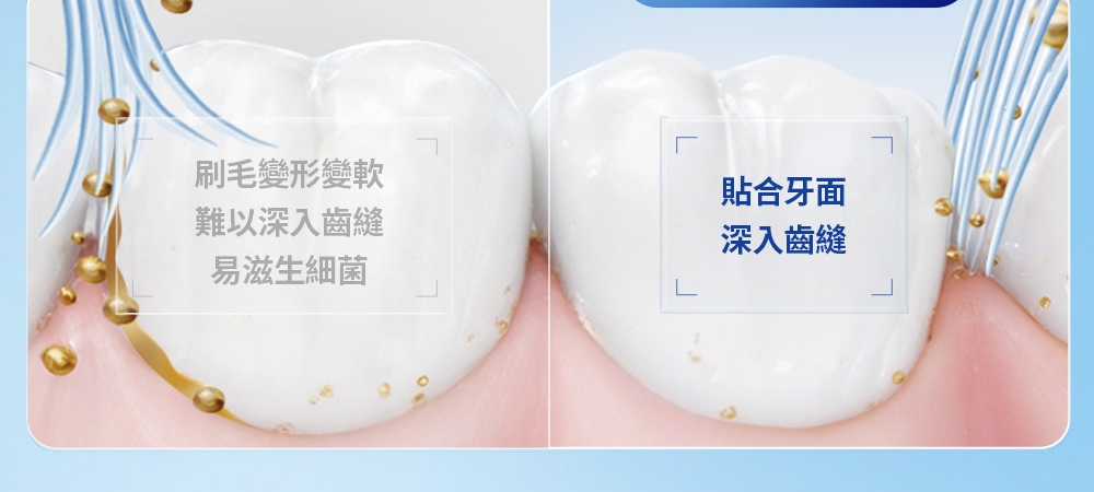 BRAUN德國百靈 Oral-B-iO3 - 詳情5