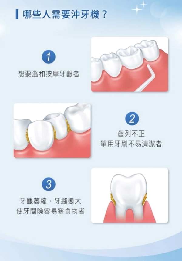 Panasonic國際牌 EW-1613 - 詳情3