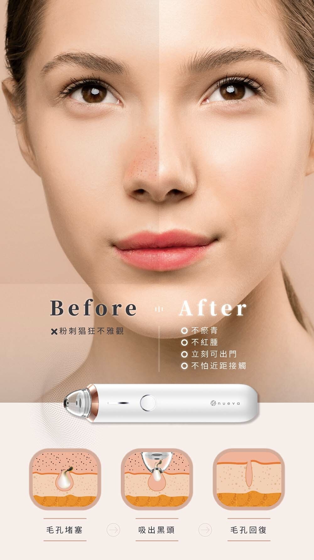 NUEVA Aurora - 詳情5