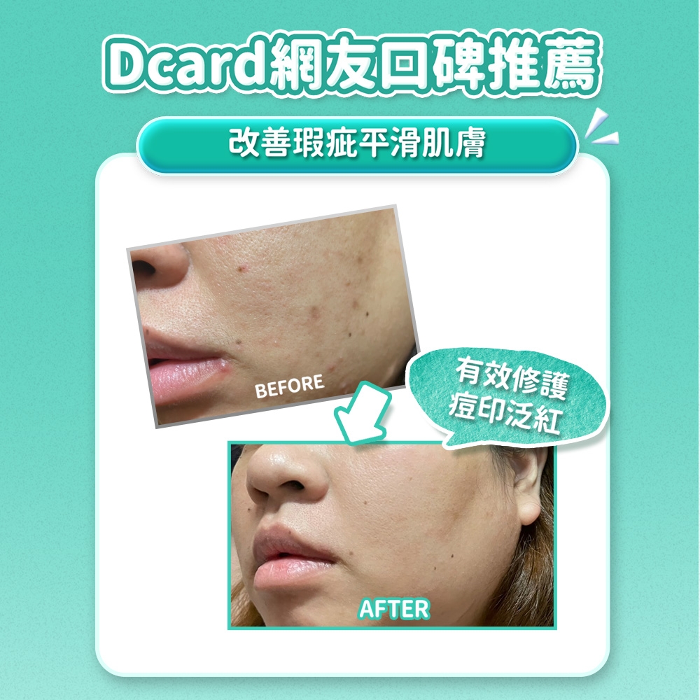 專科淨荳煥膚修護凝露50g | 清潔/卸妝| Yahoo購物中心