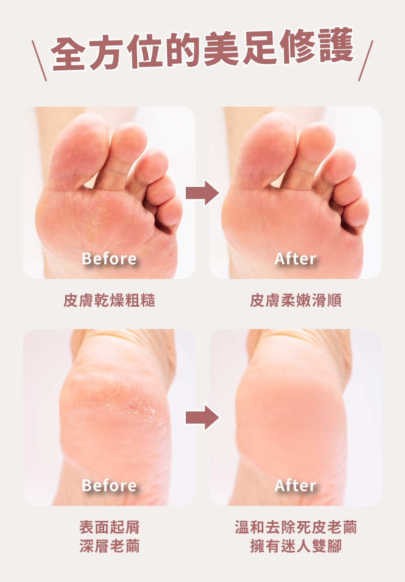 MUNICHI沐尼黑 MR.FEET - 詳情12